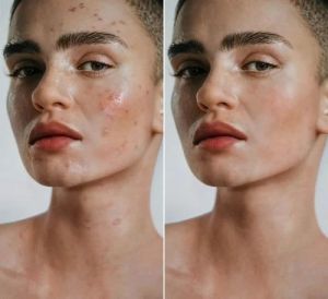 On-Model Natural Skin Image Retouching Services