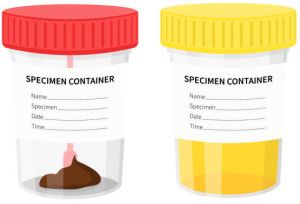 Urine Stool Culture Bottle