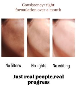 Retinol Hyaluronic Acid Vitamin E Anti Aging Face Cream