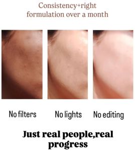 Hyaluronic Acid Anti Aging Serum