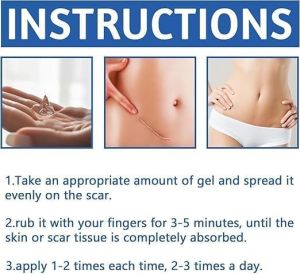 Scar Removal Cream