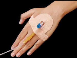 Cotton Easy Fix Cannula Fixator