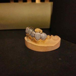 Mens Trendy Iced Out Diamond Grillz Set