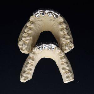 Iced VVS Moissanite Grillz