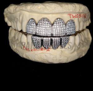 Iced VVS Moissanite Grillz