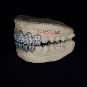 Iced VVS Moissanite Grillz