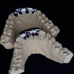 Iced VVS Moissanite Grillz