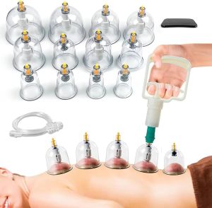 Deep Tissue Cupping Therapy Service