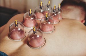 Detox Cupping Therapy Service