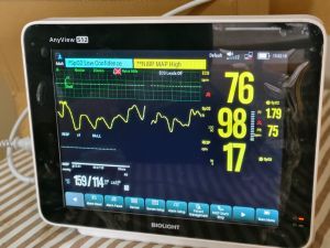 Biolight Anyview S12 Patient Monitor