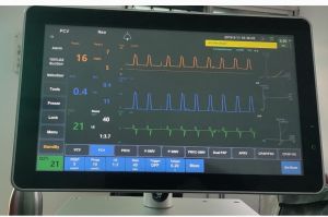Ventilator Machine