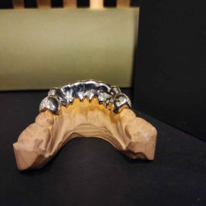 Men\'s Trendy Hip Hop Diamond Custom Grillz Set
