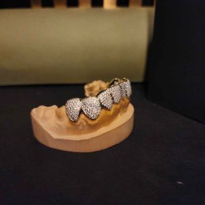 Men\'s Trendy Hip Hop Diamond Custom Grillz Set