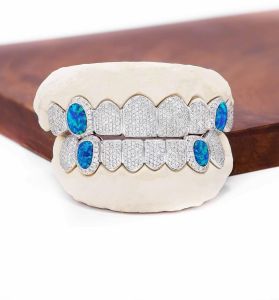 Custom Diamond Grillz with Blue Opal Stones