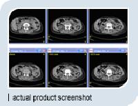 medical imaging system