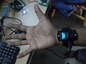 Debug logger watch