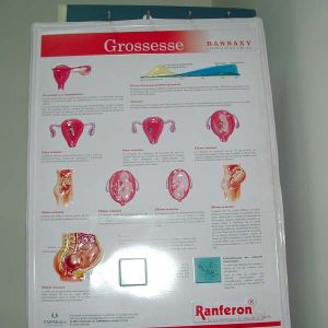 Thermoforming Posters