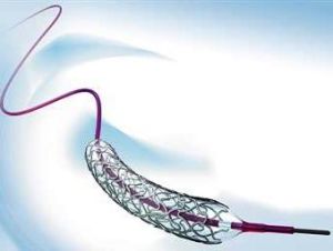 Bare Metal Tsunami Gold Stent