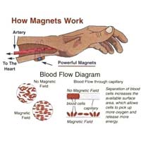 Magnet Therapy