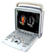 doppler ultrasound scanner