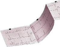 ECG Paper Roll