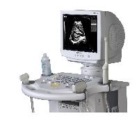 Ultrasound System