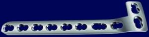LCP L-Buttress