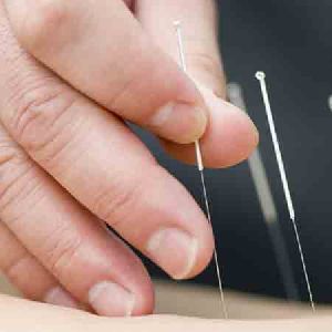 acupuncture needle