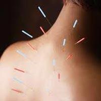 Acupuncture Therapy 01