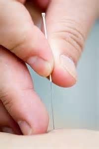 Acupuncture Therapy 02