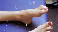 Acupuncture Therapy 04