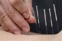 Acupuncture Therapy 05