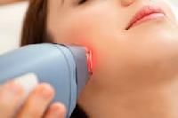 laser treatment