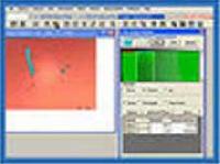 Medical Plus Image Analysis Software