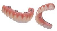 artificial acrylic teeth