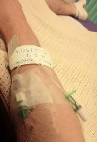 IV Cannula