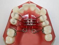 orthodontic appliances