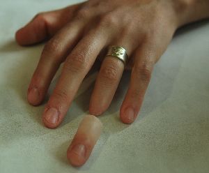 SILICONE FINGER PROSTHESIS