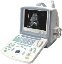 Ultrasound Scanners UT-Scan