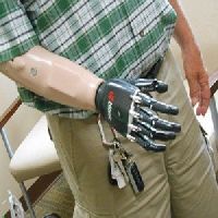 Myoelectric Upper Extremity Prosthesis