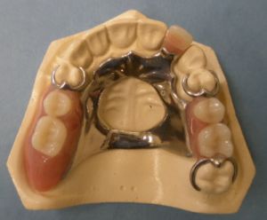 artificial teeth