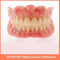 Dentures Upper/Lower (Removal)