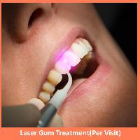 Laser Gum Treatment