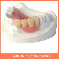 Partial Dentures (Removale)