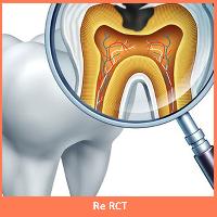 Re Root Canal Treatment