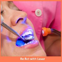 Re Root Canal Treatment with laser
