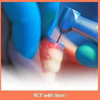 Root Canal Treatment with Laser