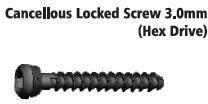 Cancellous Locked Screws