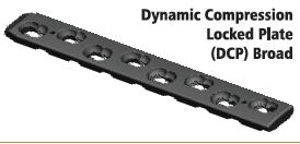 Dynamic Compression Lower Limb Plate