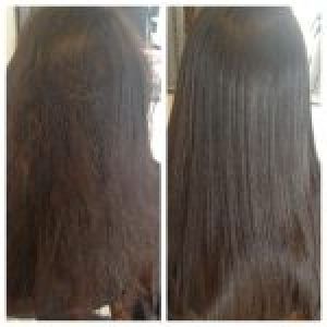 hair fall treatment services